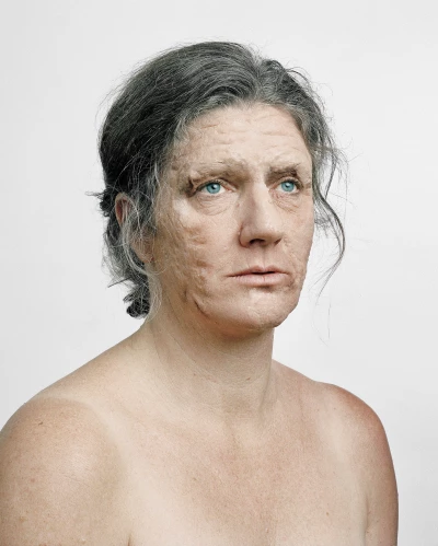 What Skin Remembers