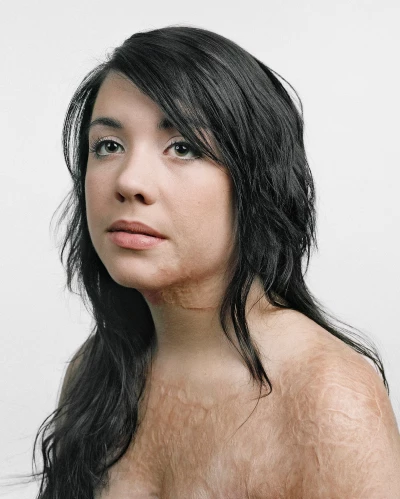 What Skin Remembers