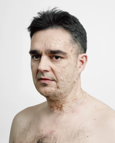 What Skin Remembers