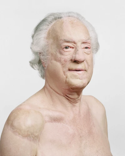 What Skin Remembers